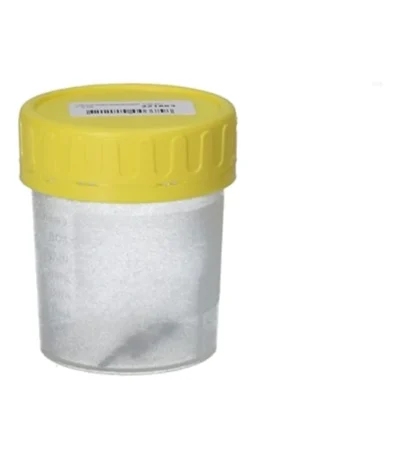Urinprøvebæger 100 ml – 1 stk